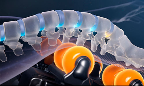 Tecnología de Columna Vertebral